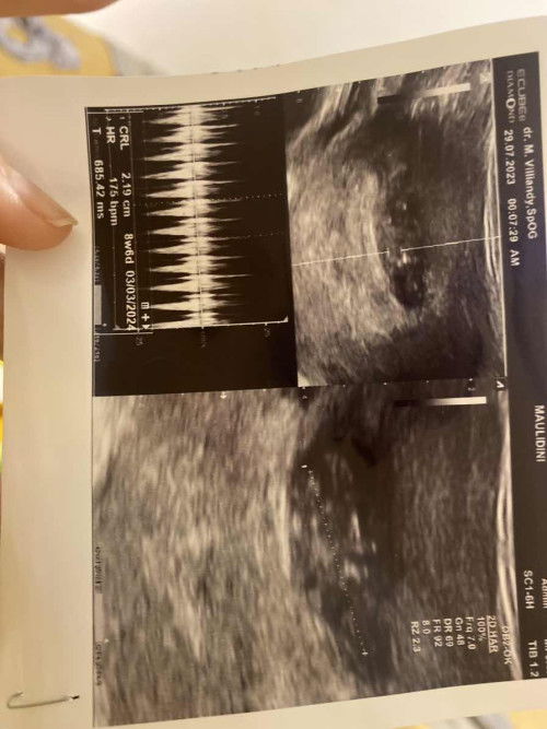 Kemungkinan keguguran