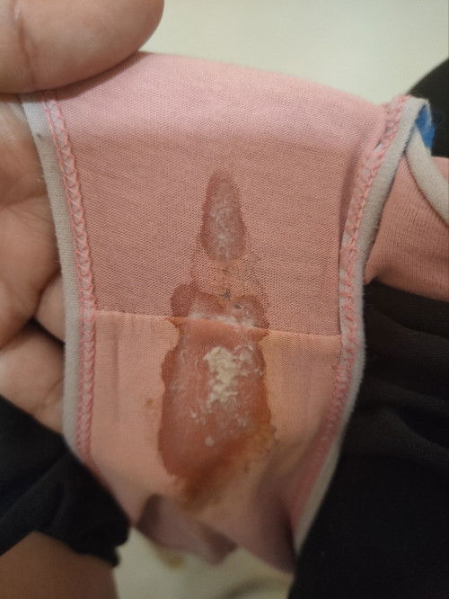 11 weeks and 5days white blood