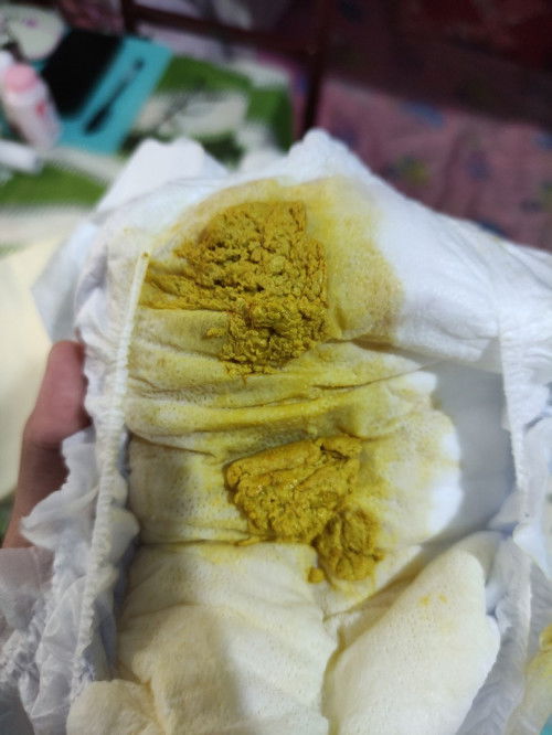 Normal lang po ba ang ganitong pupu ng newborn? Hiyang po kaya sa gatas or hindi? S26 po ang gatas