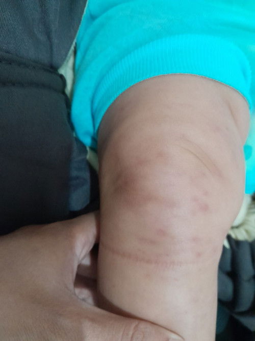 Bintik merah pada kaki