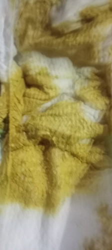 Saya mau nanyak Bun kalau bayi bab nya kuning gtu apa ada masalah di badan nya apa ada yang sakit