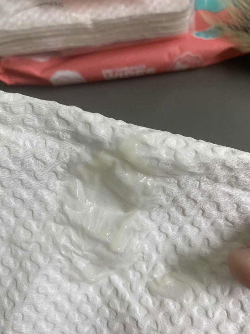 25+3 week  สอบถามแม่ๆค่ะเป็นตกขาวสีนี้แต่ ไม่เหม็น ไม่คัน ไม่แสบ ปกติมั้ยคะ กังวลมากค่ะ พึ่งเป็นเยอะ เยอะแบบไหลมาเอง