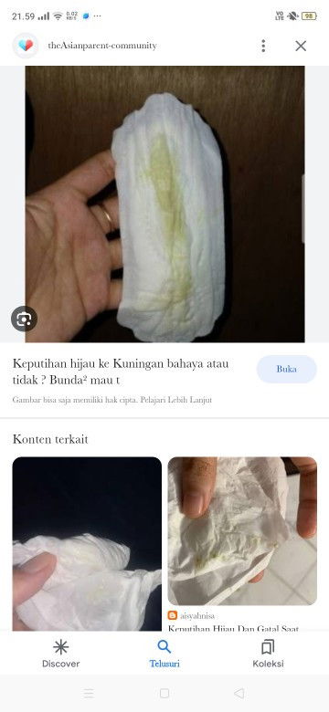 Keputihan hijau kekuningan tidak bau dan gatal