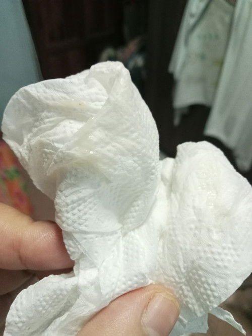 มีมูก มูกเลือด อีกนานไหมจะคลอด ตอนนี้ 37+4 วีค