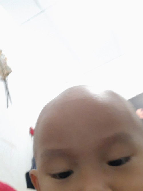 Bentuk Kepala Bayi