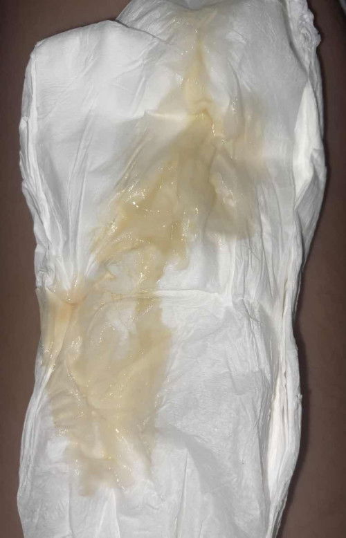 41 weeks and 1 day pregnant