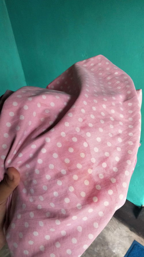 Bund ini bercak darah apa gimana ya?semalem mules tapi sekarang ilang lagi mulesnya
Sekarang 39mingg