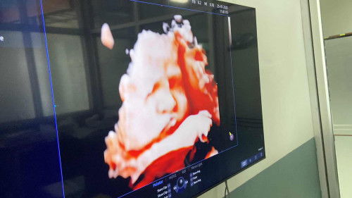 จากภาพซาวแม่ๆว่าจมูกน้องบานไหมคะ?