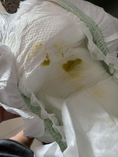 Hi mga mommies. Sino po naka experience ganito poop ni baby after magchange ng formula milk?