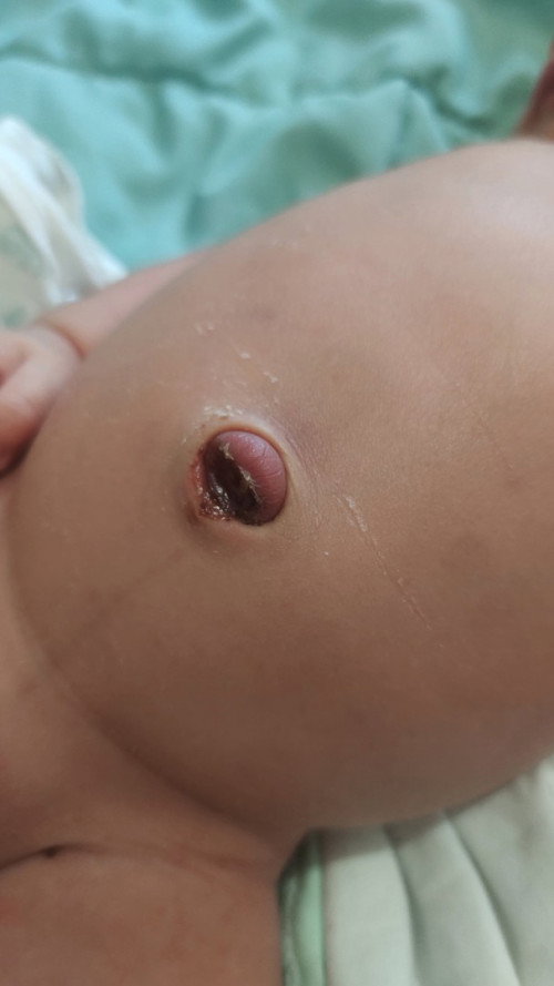 Puput tali pusar