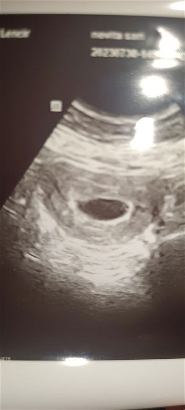 7 week belum terlihat janina