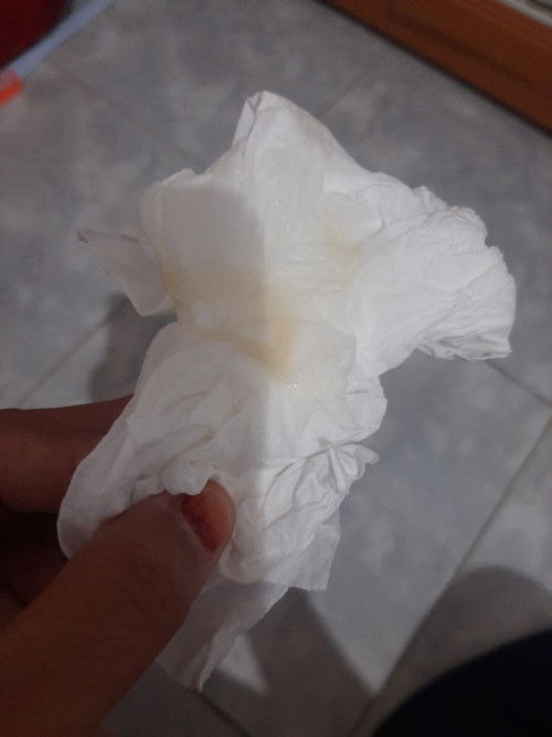 Keluar lendir bun,Uk 39 3hri  apa ini tanda mau melahirkan ya bun.