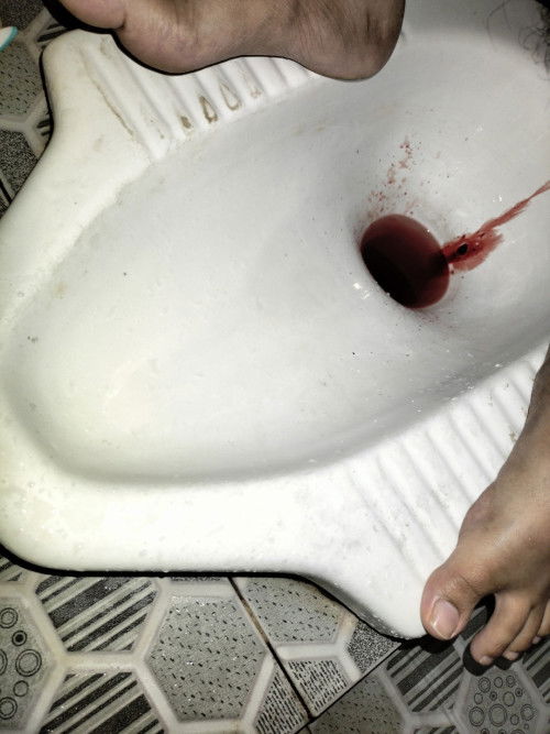 Bun saya mau tanya dong , saya hamil masuk 28 week 4 hari udh 2 hari lalu saya bab keluar drh knp y?