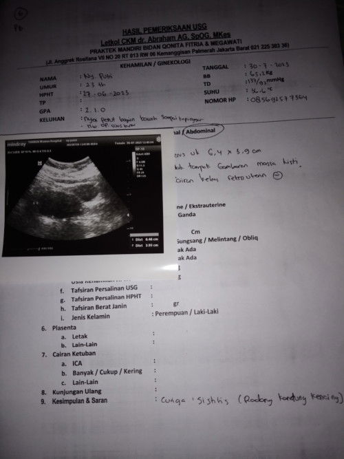 Halo bunda" boleh share pengalaman aku gak