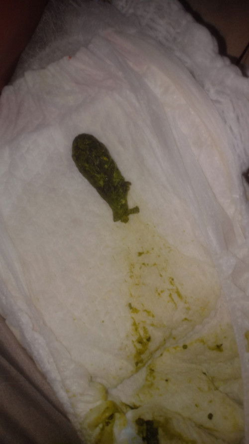 eprmasalahan pup baby