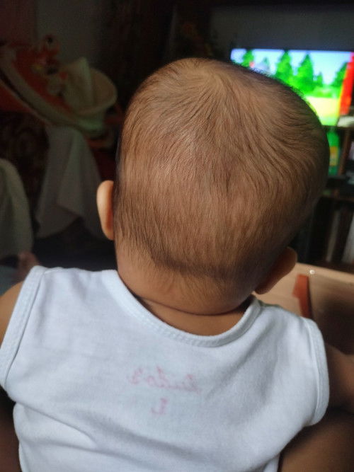 Tabingi po ba ulo ni LO