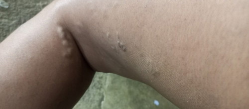 Ugat ugat na lumalabas