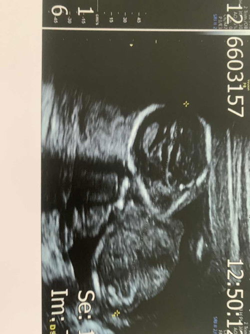 ขอดูภาพซาวด์ของแม่ๆหน่อยค่า 🥰