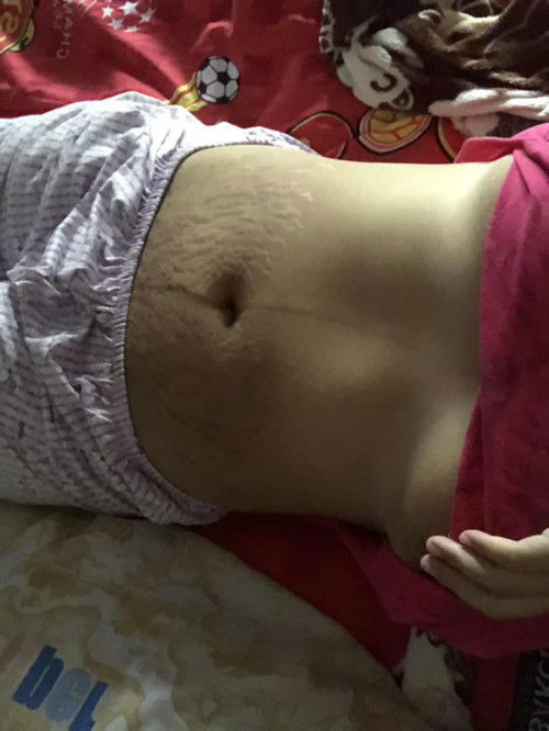 พังมากครีมตัวไหนดีแนะนำหน่อยค่ะ😢