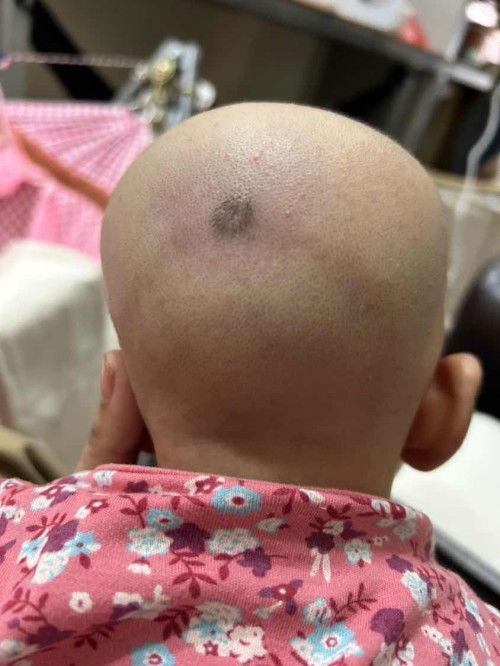 มีแม่ๆท่านไหนทราบบ้างไหมคะว่าคืออะไร