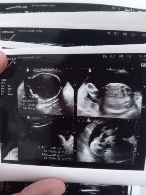 ขอวิธีคุมอาหารหน่อยค่าาา