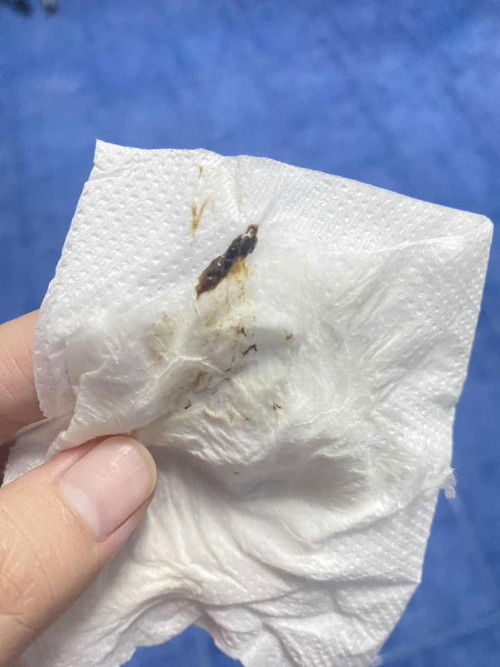 สอบถามแม่ๆหน่อยค่ะ