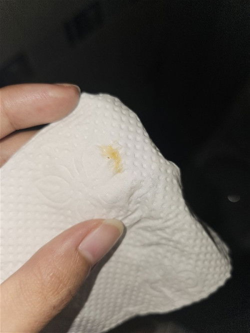 ตกขาวหรือมูก