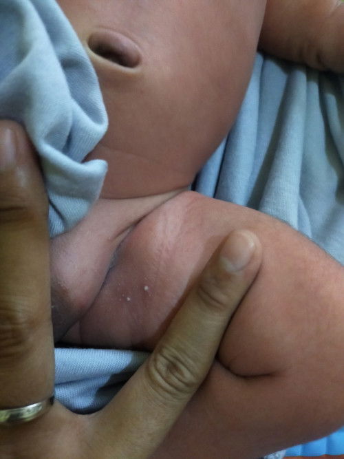 Ada bintik putih di selangkangan