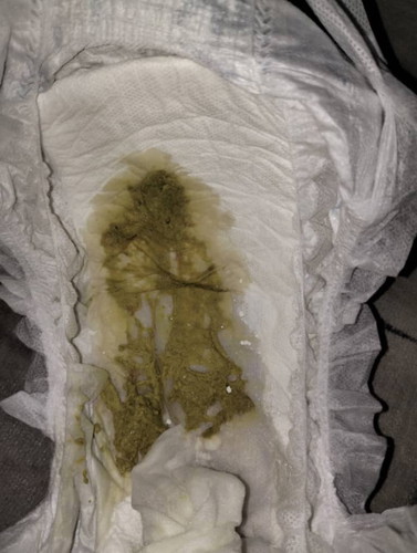 baby 9bulan asyik berak2 , kena tukar susu ke apa ya ? najis dia macam berketul kecik2 . kdang mcam
