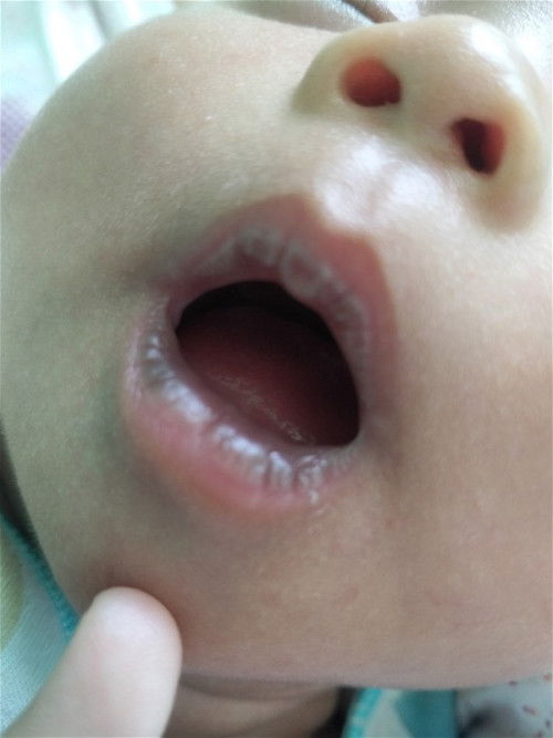 Bibir bayi 1 bulan menghitam