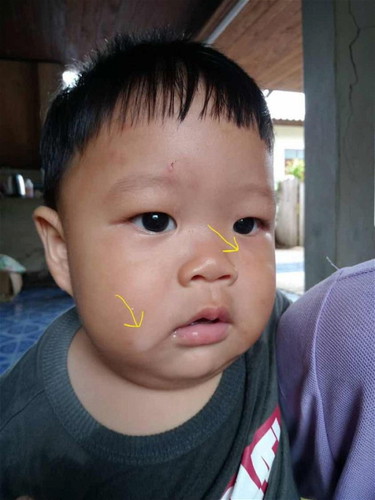 เอาไรทาให้หายค่ะ