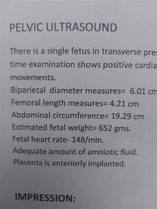 Mababa po ba weight ni baby?