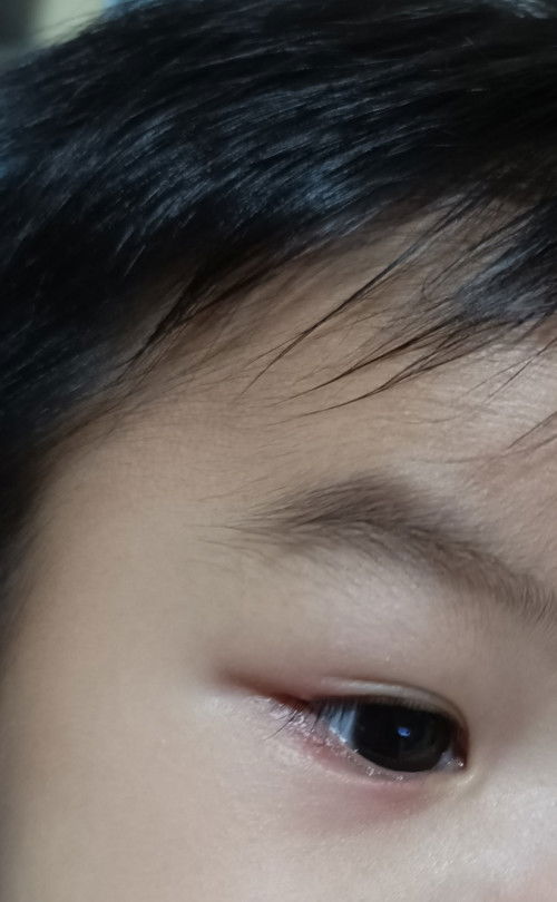 Mga miii help ano po kaya un namumula sa mata ni baby