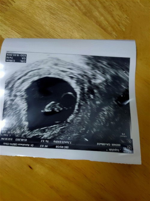 เจอหัวใจน้องตอนไหนคะ