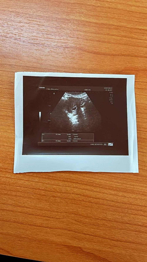 แฝดหรือไม่แฝด