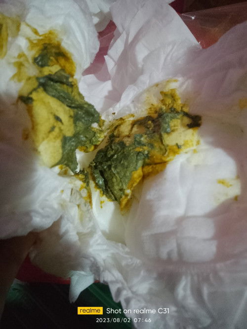 Bab bayi warna hijau sudah sebulan lebih