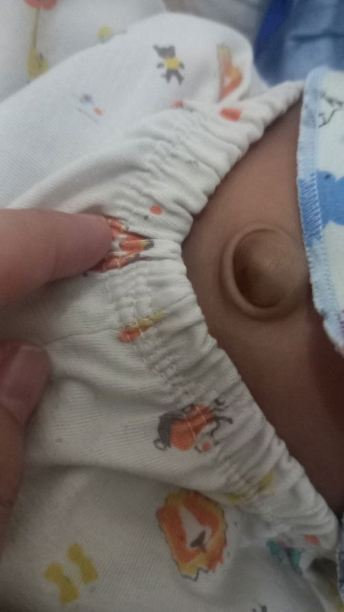 udel seperti bengkak