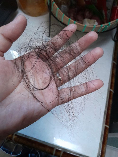 Rambut rontok pasca melahirkan dan menyusui