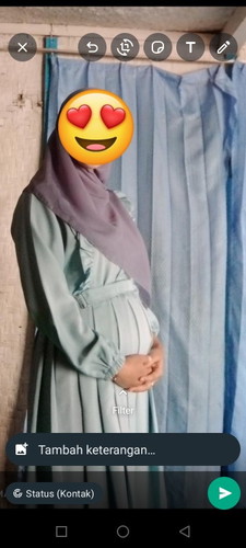 Kata orang" perut ku kecil Bun padahal udah 27 week ,, normal ga yah maaf nanya soal nya hamil prtma