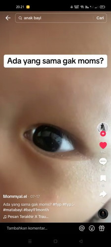 Ada cahaya putih di sudut mata bayi