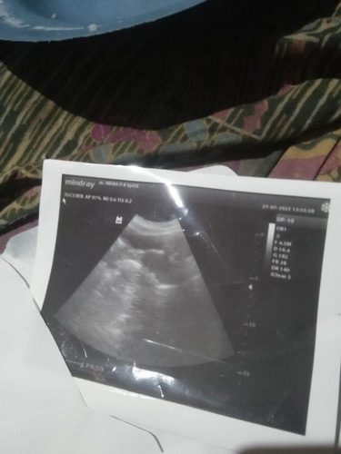Bun mau nanya apakah hasil USG ini positif/negatif atau dalam proses mohon bun kasih penjelasan 🙏🙏