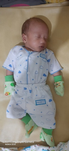 Warna kulit bayi asli bayi kira kira diusia berapa bulan ya