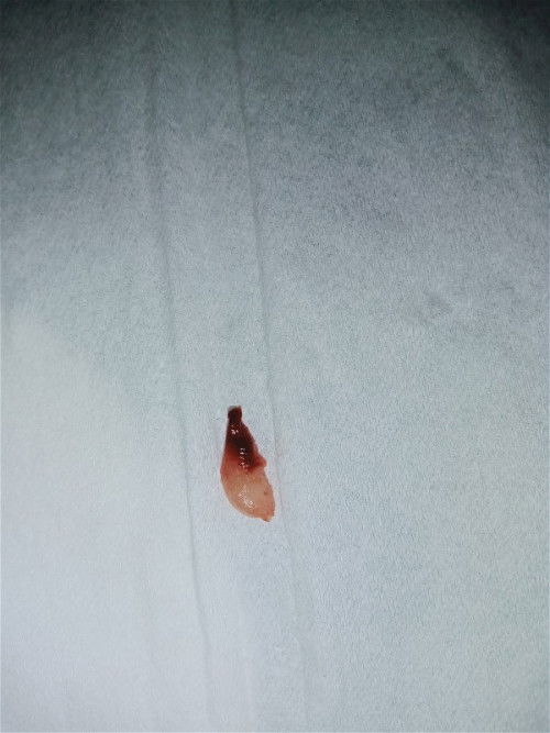 Janin keguguran atau bukan?