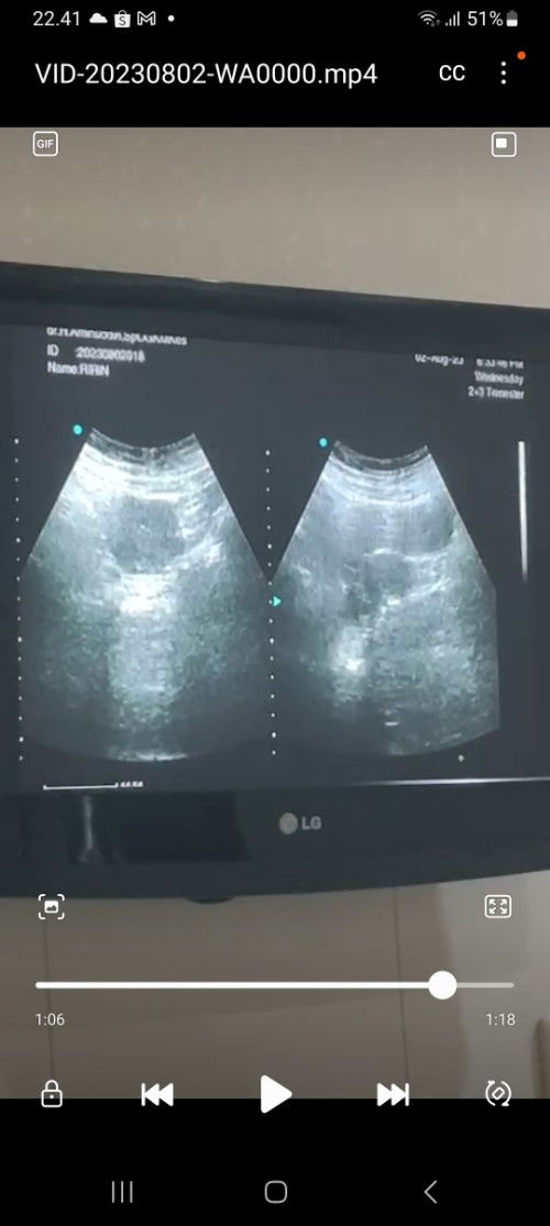 Alhamdulillah adek ada didalam 🥰