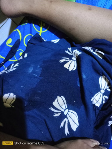 Antara ketuban plus keputihan atau lendir