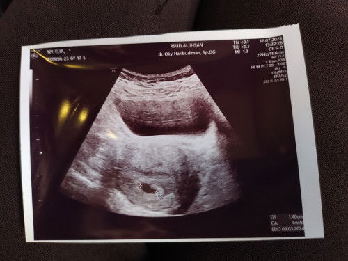 BELUM TERLIHAT JANIN USIA 6 MINGGU
