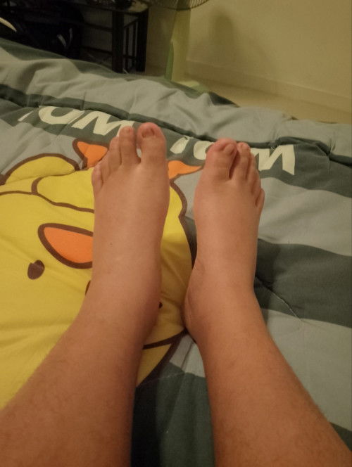 อาการบวมของคนท้อง5เดือนปกติไหม