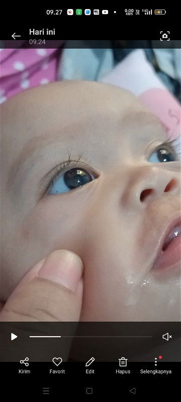 Satu titik dibagian mata'putih warna kuning