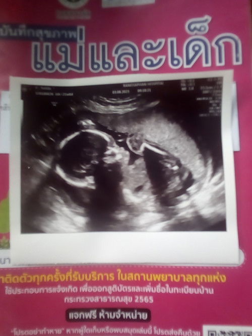 อันเตอร์ซาวร์