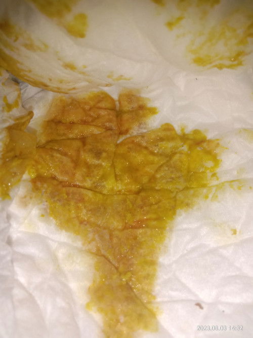 Bayi 4 bulan diare d sertai ada bercak seperti darah